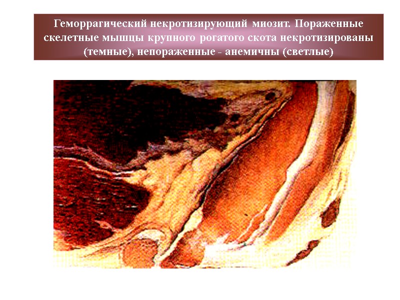 Геморрагический некротизирующий миозит. Пораженные скелетные мышцы крупного рогатого скота некротизированы (темные), непораженные - анемичны